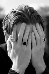 hands on face with rings showing black and white